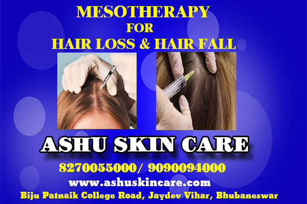 best mesotherapy for hair loss and hair fall clinic in bhubaneswar near capital hospital